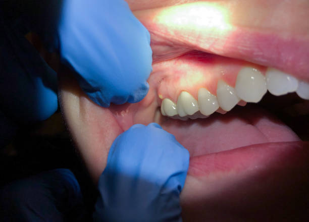 Best Weekend Emergency Dentist in Lorenz Park, NY